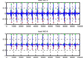 Fig. 3: Features Extracted From Leads After Applying  PCA. 