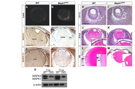 Fig. 2. Reduction in epithelial cells in Mapk1as the mutant lenses aged. *CKO lens. The number ofepithelial cells was similar in E11.5 Mapk1CKO and WT lenses, but declinedP<0.0001 versus WT; error bars indicate s.e.m.