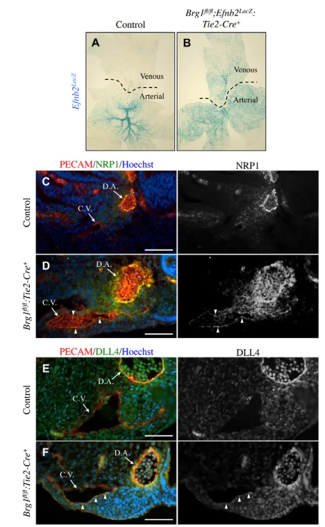 Fig. 3. Brg1Tissues from E10.5 littermate control and fl/fl:Tie2-Cre+ veins aberrantly recruit smooth muscle cells.Brg1fl/fl:Tie2-Cre+ mutants were