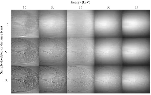 Figure 3Video image quality as a function of x-ray energy and sample-detector distancestant