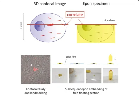 Figure 1 Outline of correlation of confocal and EM images. Three-dimensional (3D) reconstructed confocal data of the pretangles wereobtained from a free-floating section