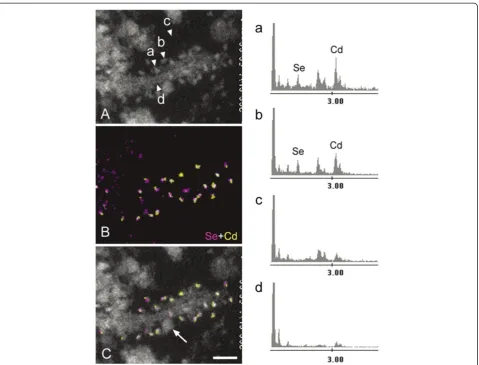 Figure 2 EDX mapping of QDs around tau-positive straight filaments in a case of CBD.(arrowheaddelineate the QD particles in relation to underlying ultrastructures