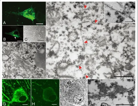 Figure 3 Correlation of immunolabeled LM and EM images of Alzheimer disease (AD)-type pretangles.corresponded to 15-nm straight filaments widely and randomly distributed throughout the cytoplasm on EMoccasionally seen in pretangle neurons of AD A mixture o