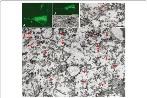 Figure 4 Correlation of immunolabeled LM and EM images of CBD-pretangles.corresponded to a few 15-nm straight filaments assembled roughly in parallel