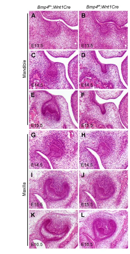 Fig. 3. Molar developmental defects in the Bmp4embryos.the developing first molar tooth germs of f/f;Wnt1Cre (A-L) Hematoxylin and Eosin-stained frontal sections throughBmp4f/+;Wnt1Cre control(A,C,E,G,I,K) and Bmp4f/f;Wnt1Cre mutant (B,D,F,H,J,L) mouse embryosfrom E13.5 to E16.5 are shown.