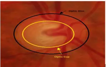 Figure 1: Main components in a fundus image 
