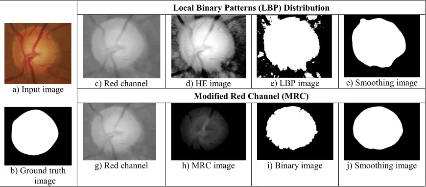 Figure 4: A sample output of segmentation of optic disc boundary on both proposed methods 