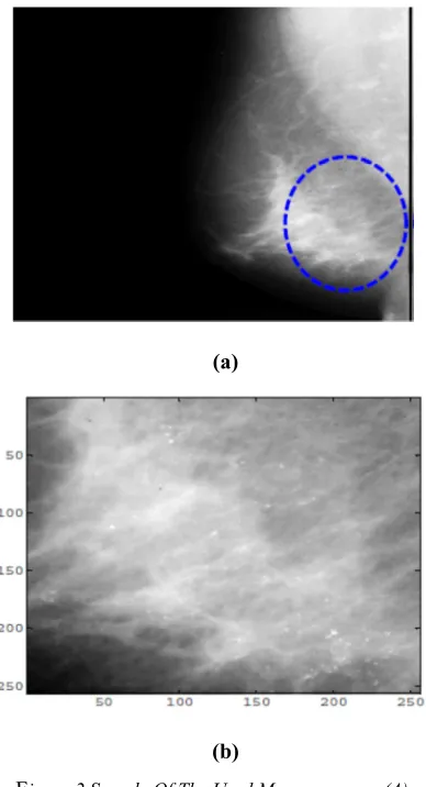 Figure 2 Sample Of The Used Mammograms: (A) 