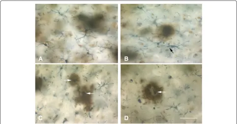 Figure 8 Ramified and dystrophic microglia are associated with amyloid-beta protein deposits.Bar = 50deposits are colocalized with ramified, non-activated microglia,dystrophy (arrow points to early fragmentation and spheroid formation).is comprised of dyst