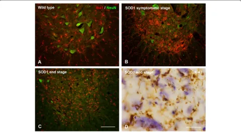 Figure 9 Microglia in the spinal cord of SODG93A rats. A-C, double staining for microglia (Iba1) and neurons (NeuN) shows progressive loss ofneurons during symptomatic and end stages of motor neuron disease
