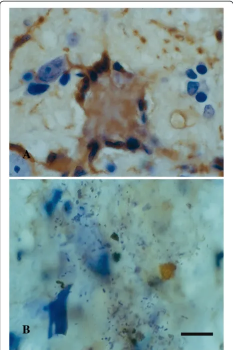 Figure 11 Microglial pathology is evident in rats exposed to nerve agent. Double immunofluorescent staining for microglia (OX-42) andcytokines (MCP-1 in A; IL-1α in B) in soman exposed rats