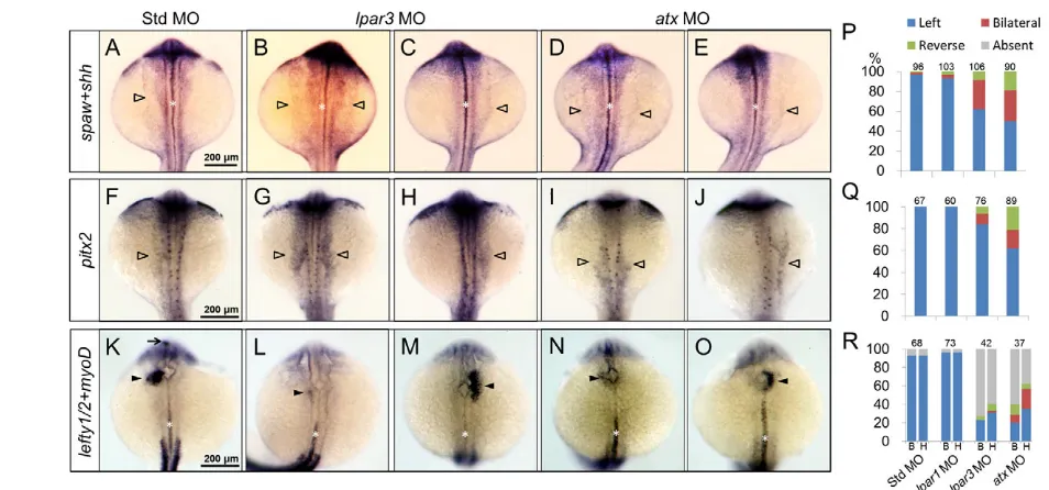 Fig. 2. Asymmetric gene expression is disturbed in lpar3For each treatment, embryos from two independent batches were analyzed