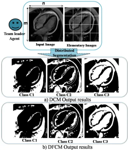 Figure 7: Output MRI cerebral images results by the distributed segmentation. a) The   DCM program results; b) The DFCM program results  