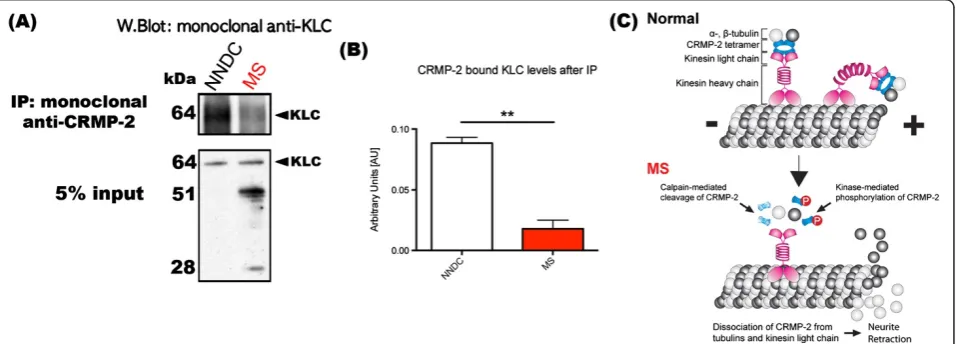 Figure 3 Disturbed interaction between CRMP-2 and kinesin light chain in MS. Tetrameric CRMP-2, may act as a cargo protein transportingmolecules such as α- and β-tubulin heterodimers anterogradely with the aid of kinesin-1