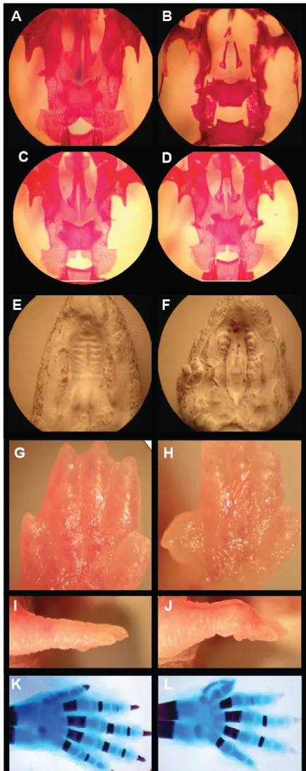 Table 1).To verify that venation defects were the result of irk2 deficiency,view of Alizarin Red (bone) staining of palates of newborn wild-type(A), Kir2.1 knockout (B) and Kir2.1 heterozygous knockout (C,D) pups.