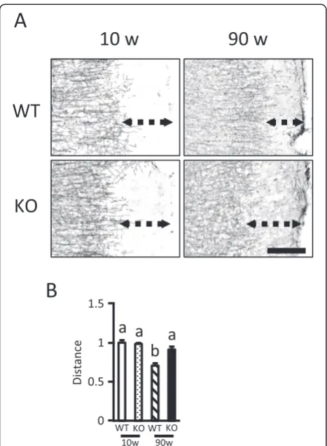 Figure 9 Disrupted myelination in the cerebral cortex of agedPGRN-deficient mice. A, Binary MBP-immunostained images in theTeA and Ect of 10- and 90-week-old WT and KO mice (scale bar = 200μm)