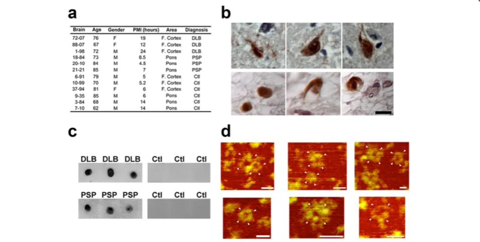Figure 2 Tau APFs are present in DLB and PSP brain tissue. The age, gender, post-mortem interval (PMI), and sampled brain regions in eachgroup is summarized (a)
