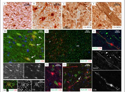 Figure 5 Cell associated C3b complement staining.immunolabelled with anti-C3b showing cells with astrocytic morphology
