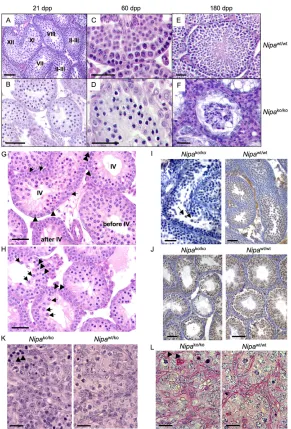Fig. 2. Nipaprogression. oocytes (arrowheads) are left. Scale bars: 100stages after IV showing preleptotene (arrowheads)spermatocytes and few older stages (arrows) that survivedstage IV but enter apoptosis later on without reachingmeiotic divisions