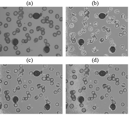 Fig. 2 Sample 1 (A) Real Image (B) FCM (C) SKM (D) EKM 