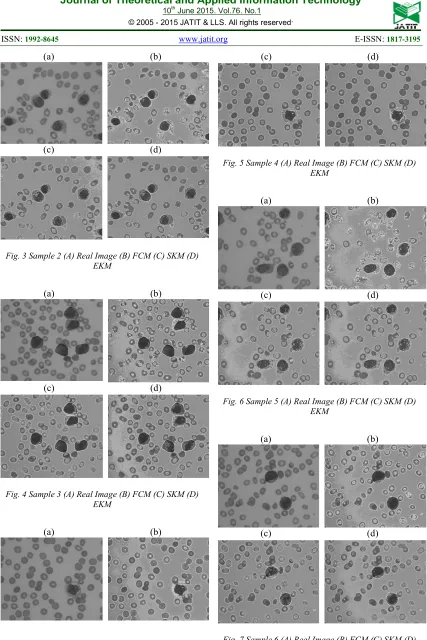 Fig. 7 Sample 6 (A) Real Image (B) FCM (C) SKM (D) EKM 