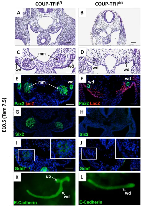 Fig. 1. Expression pattern and conditional deletion of COUP-TFIIindicates that COUP-TFII is not expressed in the Wolffian ducts, whichare stained positively with Pax2