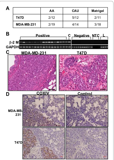 Figure 4 Caucasian-American extracellular matrix molecules (ECM) enhances metastasis to lung