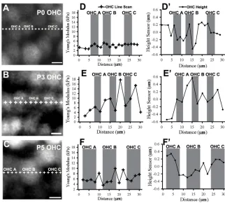 Fig. 4. Outer hair cell rows show