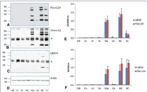 Figure 4 Detection of disease-associated α-synuclein (αSD) in different neuro-anatomical regions of M83 mice by ELISA and Westernblot