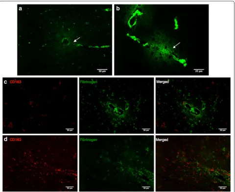 Figure 5 Double immunofluorescence of CD163 with fibrinogen. (a and b) Immunofluorescence for fibrinogen in the (a) occipital cortex ofan AD case and (b) cingulate cortex of a PD case