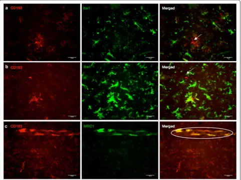 Figure 4 Double immunofluorescence of CD163 with microglia/macrophage markers Iba1 and MRC1