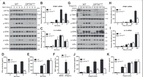 Fig. 6 Impaired TBK1 activation after RLR or TLR3 stimulation in OPTN-deficient primary cells