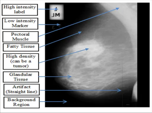 Figure 1: shows of different components in the image mammography. 