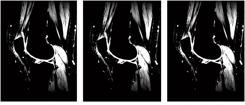 Figure 6: Stretching DICOM Image