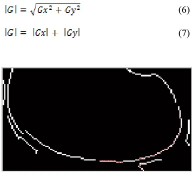 Figure 14: Sobel Edge Detection 