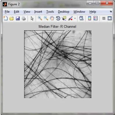 Figure 1: Input Image 