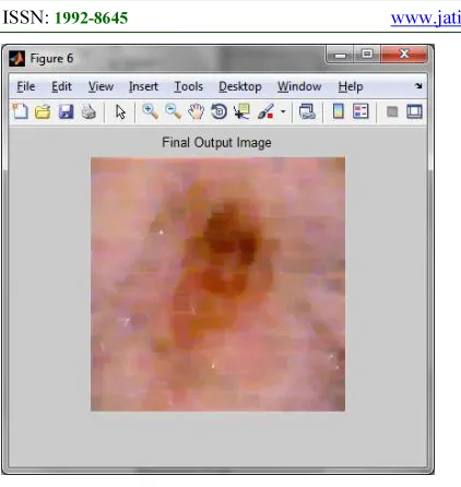 Figure 6: Final Morphological Image 