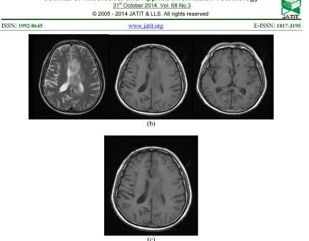 Fig 4: (A) Input Query Image, (B) After Neural Network Process (C) Retrieved Output 