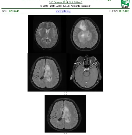 Fig 5: (A) Input Query Image, (B) After Neural Network Process (C) Retrieved Output 