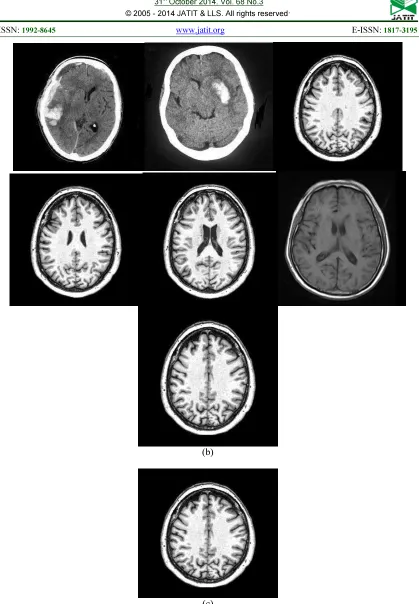 Fig 6: (A) Input Query Image, (B) After Neural Network Process (C) Retrieved Output 