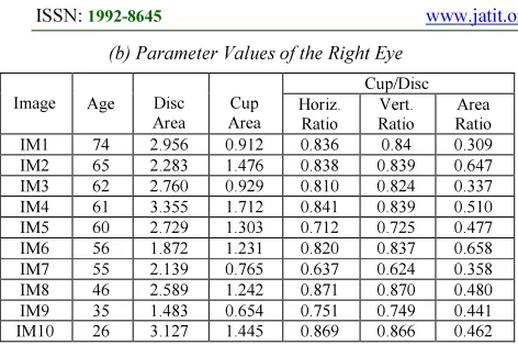 Table 5: Percentage of Glaucoma 