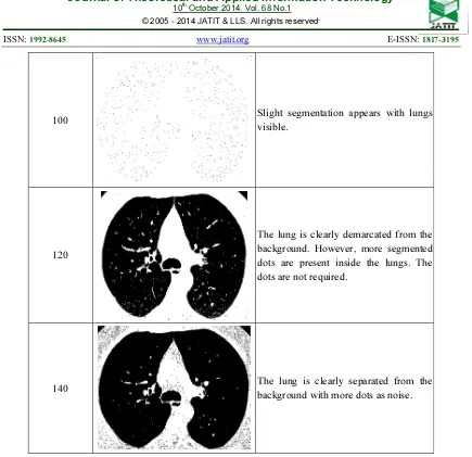 Table 1 shows the segmented images from cropped image obtained from the original CT lung image