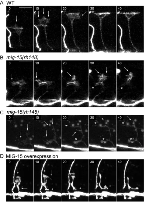 Fig. 4. Abnormal growth cone protrusive activity in mig-15transgenic L2 larvae (MIG-15 overexpression; minutes on each frame