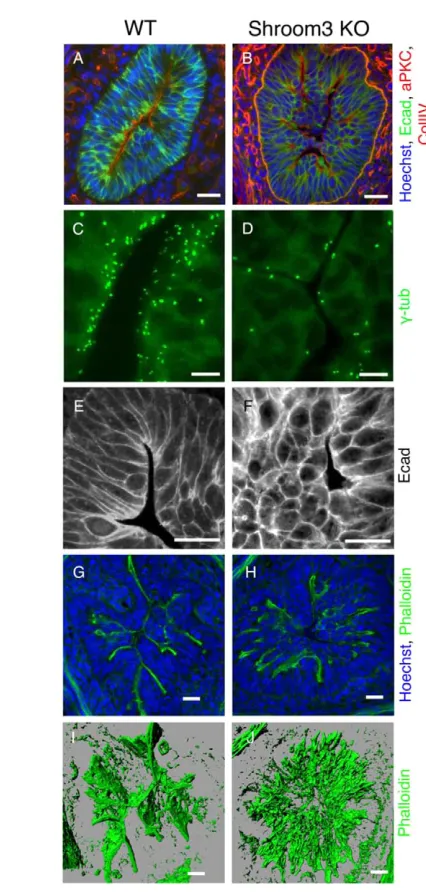 Fig. 7. Expanded apical surfaces in Shroom3phalloidin staining. A sheet-like apical actin network covers emergingvilli in WT intestines; this network is disorganized and highly branchedin supplementary material