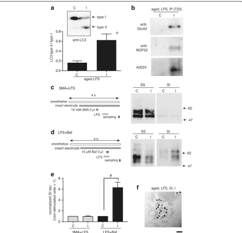 Fig. 3 The ALP in aged neurons contributes not only to LTD but also to the formation of tau oligomers.of normalized-tau levels in SI fractions from ipsilateral and contralateral hippocampi, which were obtained after LFS plus 3MA or Bafilomycinapplication (