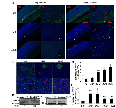 Fig. 8. Activation of the E2F1 pathways in the retinas of Map3k1**and (E) Map3k1those in in the DKD/DKD mice