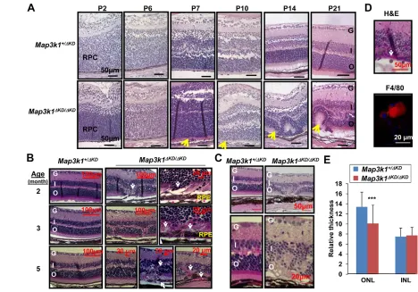 Fig. 2. MAP3K1 is required for postnatal retina development. (top panel, red, bottom panel)