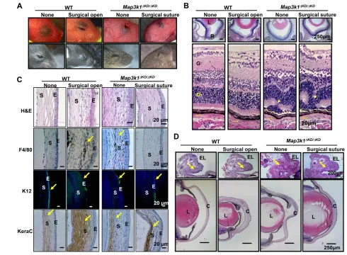 Fig. 3. The role of a closed eyelid in postnatal eye development. Mice were subjected to surgical procedures to open the closed eyelid in wildretinas were examined under the microscope
