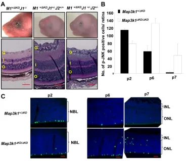 Fig. 4. Retinal defects of theDKD/DKD 