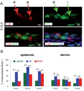 Fig. 5. Melanoblast proliferation is dependent on b-catenin signaling. (A)Immunostaining of Dct::lacZ embryousing anti-b-galactosidase (red), anti-BrdU (green) antibodiesand DAPI (blue)